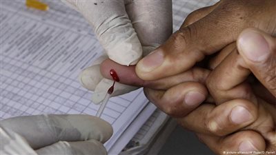 علماء يطورون اختبارا جديدا للإيدز
