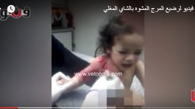 الغيطي يبرز فيديو «فيتو» لرضيع المرج المشوه بالشاي المغلي