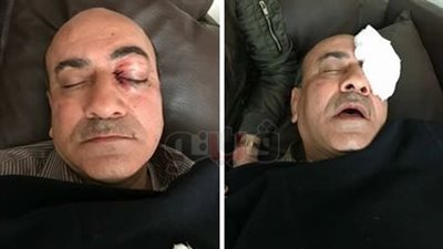 الصور الأولى لـ«هشام جنينة» بعد الاعتداء عليه في القاهرة الجديدة