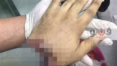 قانون الغاب «أهالي يقومون بتطبيق الحدود في الشارع»..قطع يد متهم بالسرقة في الشرابية..الضرب حتى الموت نصيب لصوص شبرا الخيمة..وأزهري: العقوبات يقيمها الحاكم لا المواطن