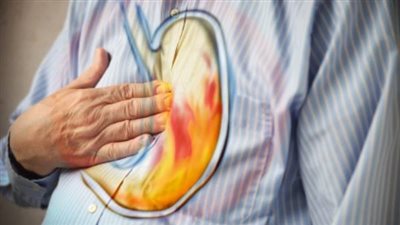 10 نصائح تحمي من الإصابة بحموضة المعدة