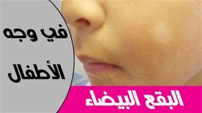فيتو