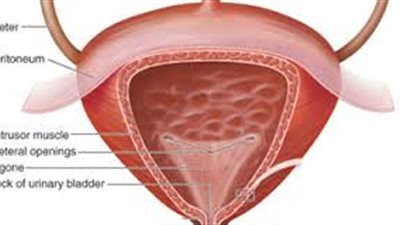 وصفة طبيعية تساعد في علاج سرطان المثانة
