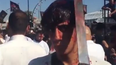 أطفال يجرحون رؤوسهم احتفالا بعاشوراء (فيديو)