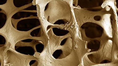 12 معلومة عن مرض «اللص الصامت»