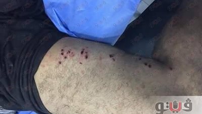 بالصور.. رمضان بطعم الدم في الشرقية.. صاحب شركة يطلق النار على عامل بسبب خلافات الجيرة.. إصابة فلاح وزوجته بخرطوش في أبوكبير بسبب قطعة أرض زراعية.. و9 آخرون ضحايا مشاجرة الأسلحة النارية في الإبراهيمية