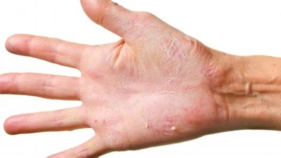 احذر.. طعم الكربوهيدرات أحد أسباب زيادة الوزن