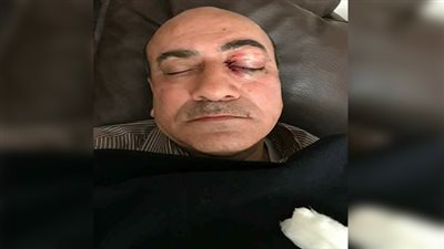 النيابة تطلب تحريات الأمن الوطني في «الاعتداء على هشام جنينة»