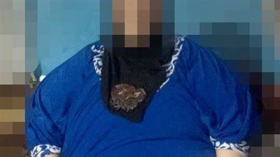 مواطنة: وزني 200 كيلو ساعدوني أخس