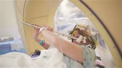 امرأة تعزف بالمزمار أثناء خضوعها لعملية معقدة في المخ (فيديو)