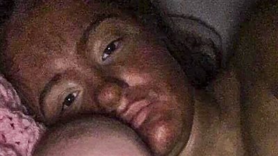 بالصور.. كريم «تان» يشوه وجه امرأة