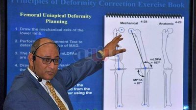 طبيب أزهرى يحاضر بمؤتمر عين شمس حول «أحدث تقنيات إصلاح عظام الأطفال»