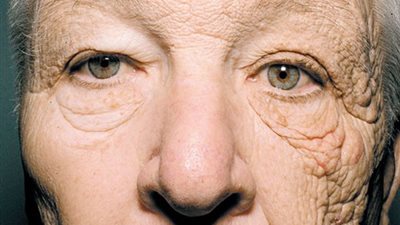 صورة صادمة لسائق تظهر أضرار الشمس على جانب واحد من وجهه