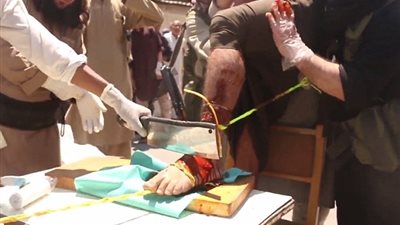 بالفيديو والصور.. «داعش» يبتر أطراف سوريين بـ«الساطور»