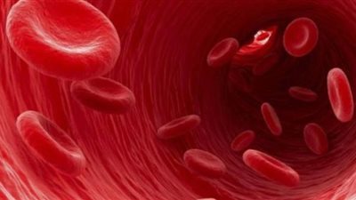 10 أعراض للإصابة بسرطان الدم الحاد