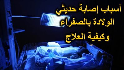 أسباب إصابة حديثي الولادة بالصفراء وكيفية العلاج | فيديو