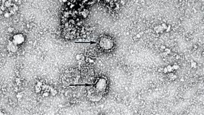 بعد امتلاكهم عينة حقيقية.. علماء أستراليون يطورون بنجاح نسخة من فيروس كورونا