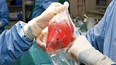 ضحايا عصابة الاتجار بالأعضاء البشرية: 