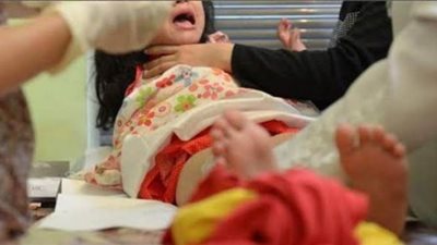 النائب العام يأمر بحبس طبيب و3 آخرين في وفاة طفلة بعد ختانها بأسيوط