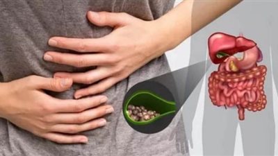 أعراض المرارة المبكرة وطرق العلاج