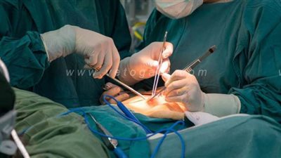 استخراج جنين من بطن طفل عمره 7 سنوات في الإسكندرية