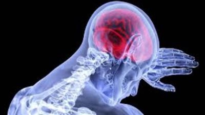 3 أعراض تؤكد الإصابة بالسكتة الدماغية