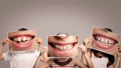 استشاري يوضح مخاطر تسوس الأسنان اللبنية وخلعها مبكرًا