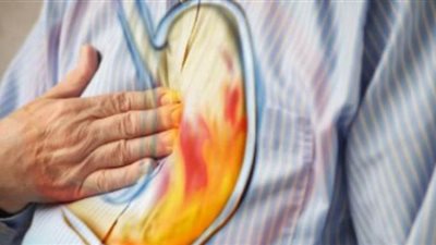 4 مواد طبيعية لعلاج الحموضة