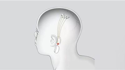 تقنية جديدة لربط الدماغ البشري بالكمبيوتر
