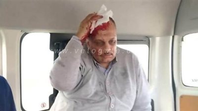 طالب يعتدي على أستاذ بجامعة الإسكندرية بطبنجة