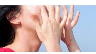 استشاري جلدية يكشف الطريقة الصحيحة لاستخدام واقي الشمس