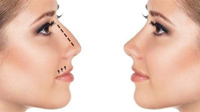 ٤ ممنوعات لا بد من التعرف عليها بعد عملية تجميل الأنف