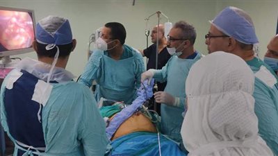 فريق طبي بمستشفى المنصورة العام ينجح في عمل تكميم معدة بالمنظار