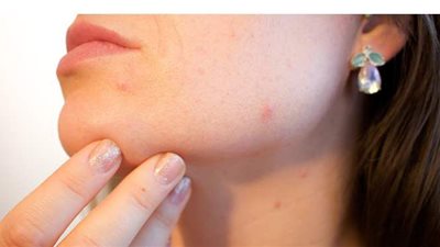 4 طرق طبيعية تخلصك من الالتهابات وبدون مضادات حيوية