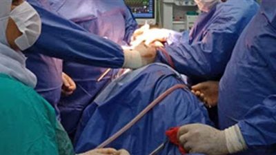 فريق طبي بالدقهلية يجري جراحة قلب مفتوح لمسن يعاني من ارتجاع شديد بالصمام الأورطي