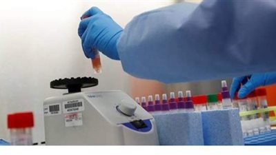 8 وفيات و513 إصابة جديدة بكورونا بين الفلسطينيين