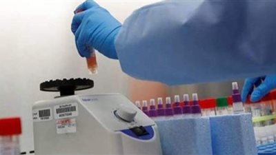 موسكو تسجل قفزة كبيرة للوفيات اليومية بكورونا