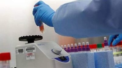 أسباب ارتفاع إصابات كورونا.. بدران: الاستهانة بالتدابير الوقائية.. عبد المجيد: التوسع في اختبارات اكتشاف الفيروس 