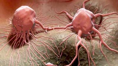 علماء يبتكرون نظاما يكشف عن مرض السرطان خلال 20 ثانية