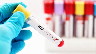 كيف ينتقل مرض الإيدز | 6 طرق للإصابة بعدوى الإيدز منها لبن الأم