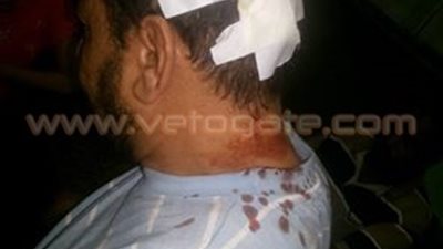 إصابة مواطن ونجلته في حادث سرقة بالإكراه بالشرقية