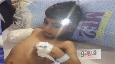 محافظ المنيا يحيل طبيبا للنيابة في واقعة بتر ذراع طفل