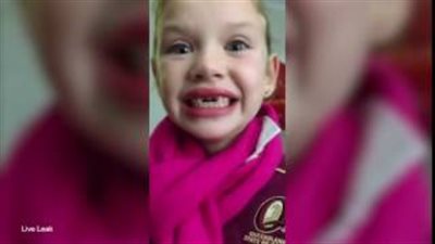 بالفيديو والصور.. رد فعل طفلة بعد خلع سنتيها الأماميتين