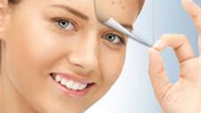 ماسك طبيعي للتخلص من حب الشباب والنمش