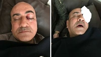 شرنوخ المتهم بالاعتداء على هشام جنينة عن إصابته: «نطيت من العربية»