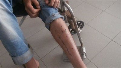 إصابة مصري بطلق ناري في الكويت