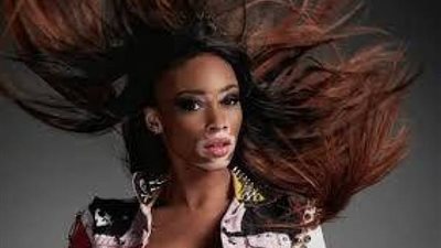 بالصور.. عارضة أزياء مريضة تخطف الأنظار في أسبوع الموضة بباريس