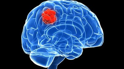 تدريب المخ يعزز مستويات الذاكرة ويقي من الإصابة بالعتة