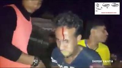 حفل زفاف في اليمن يتحول إلى كارثة (فيديو)