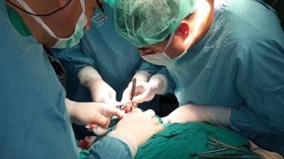 إجراء جراحة قلب نادرة لأول مرة في السويس